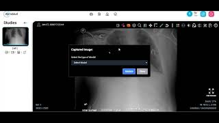 DCMCloud Integration with MAIRA 2 by Microsoft