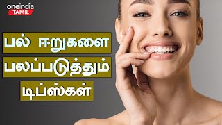 பல் ஈறுகளை பலப்படுத்தும் அற்புத டிப்ஸ்கள் | Mouth Gums Turning Black Home Remedy in Tamil