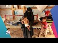 اليمن المجاعة تهدد حياة ملايين الأطفال أخبار العربي