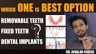 What are  Artificial Teeth Replacement Options? | Removable Teeth | Fixed Bridge | Dental Implants