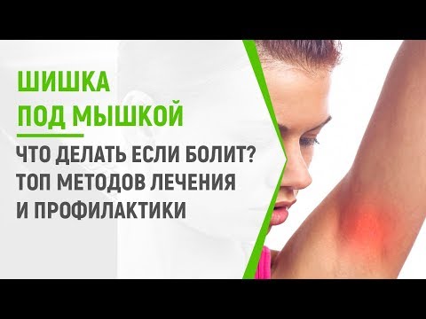 Шишка под мышкой болит: ТОП методов лечения