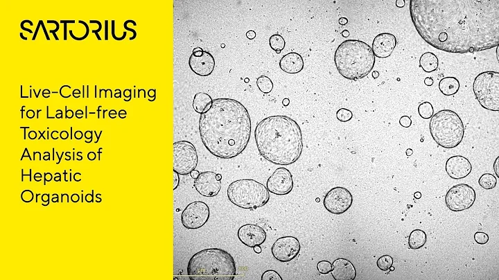 Live-Cell Imaging for Label-free Toxicology Analysis of Hepatic Organoids