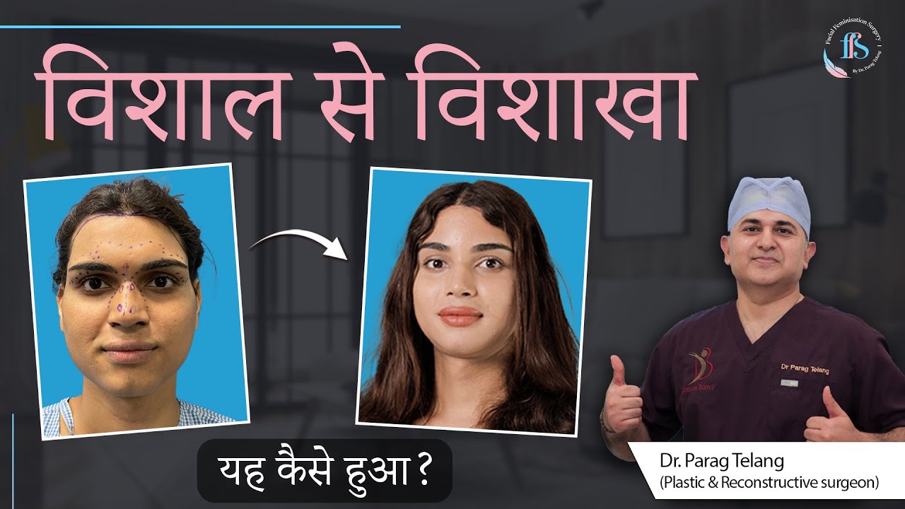 Vishal Prajapati se Vishakha Prajapati ki transformation journey | Facial Feminization surgery