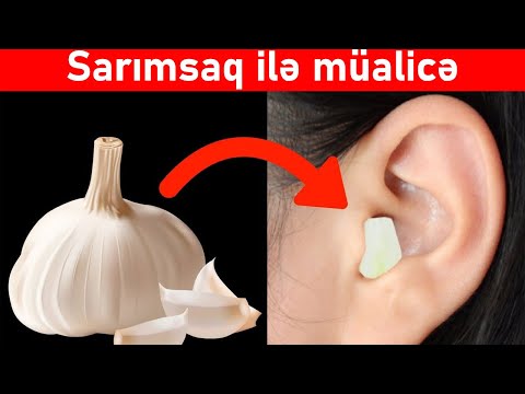 Video: Təbii şəfa Verən Soğan Və Sarımsaq