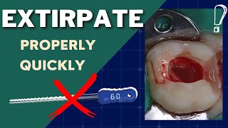 How To PROPERLY and QUICKLY Extirpate (Acute Pain)  GF016