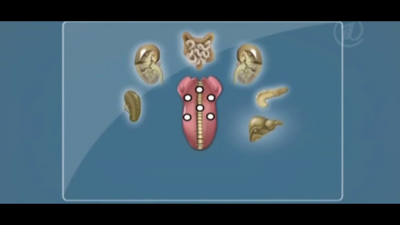 Диагностика заболеваний по языку