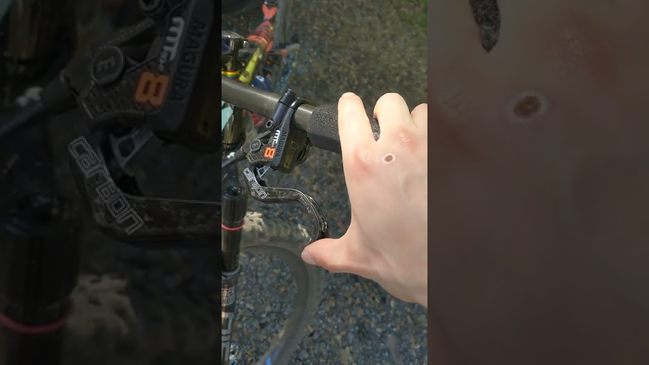 Magura MT8 SL Failure - Leaking Master Cylinder