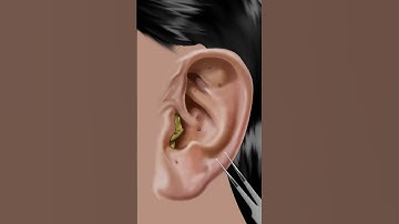 Thumbnail of #asmr Itchy & Smelly Ear Stone Removal #animation #beauty #ear