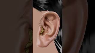 #asmr Itchy & Smelly Ear Stone Removal #animation #beauty #ear screenshot 2