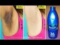 Surprising😱 In Just 5 minutes Whitening Your Dark Underarms|5 मिनट में अंडरआर्मस का कालापन दूर होगा