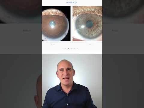 Video: ¿Los ojos gris azulados se vuelven marrones?