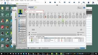 XDent Preset Treatment Notes screenshot 4