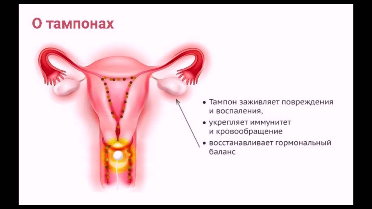 Грязевые тампоны инструкция