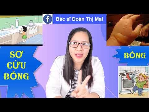 Trẻ bị bỏng: Bác sĩ hướng dẫn sơ cứu đúng cách khi bị bỏng