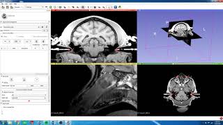 6. 3D Slicer - Create Fiducial at Stereotaxic Origin