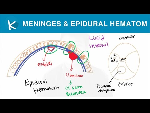 Meninges - Dura mater, Arachnoid mater, dan Pia mater - Anatomi Sistem Saraf (3/50)