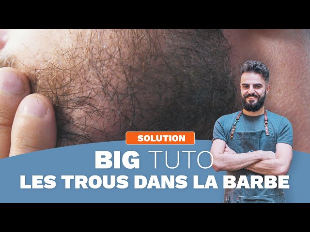 BIG TUTO - Que faire de ses TROUS DANS LA BARBE - YouTube