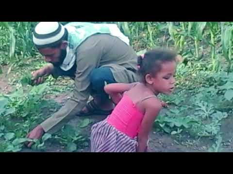 شيماء علي... أنا لست مختلفة، أنا مميزة #١٠٠_حكاية_انسانية_من_اليمن #100_humanity_tale_from_yemen