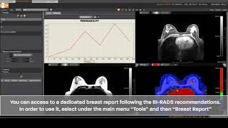 Breastscape Breast Workflow - Olea Medical