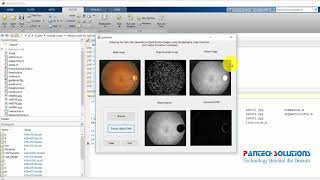 Optic Disc Boundary in  Digital Fundus Images Matlab