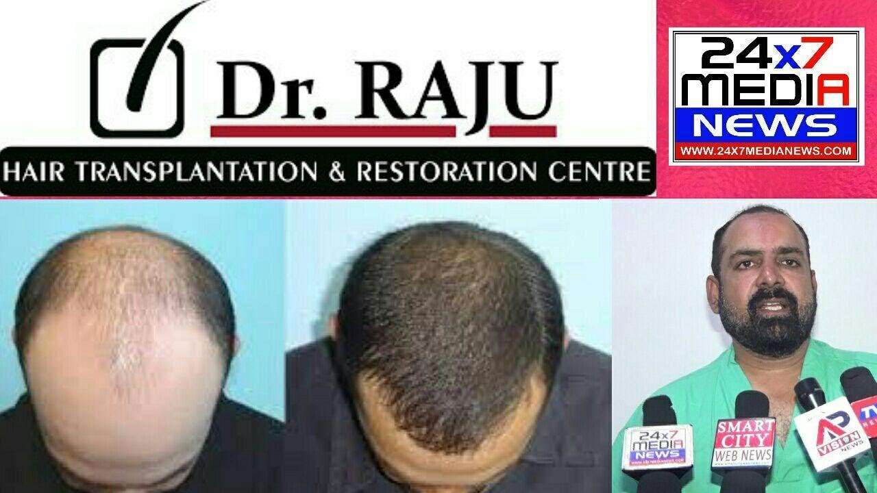 Guide for the EMI for Hair transplant treatment and Cosmetic Surgery Vizag
