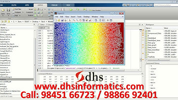 DHS MATLAB Projects Automatic Detection of Optic Disc Based on PCA and Mathematical Morphology