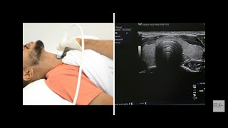 Thyroid Ultrasound Protocol