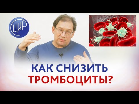 Повышены тромбоциты. Как снизить тромбоциты? Миелопролиферативное заболевание и невынашивание.