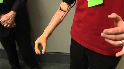 Mind-moved bionic arm helps vet use hand again