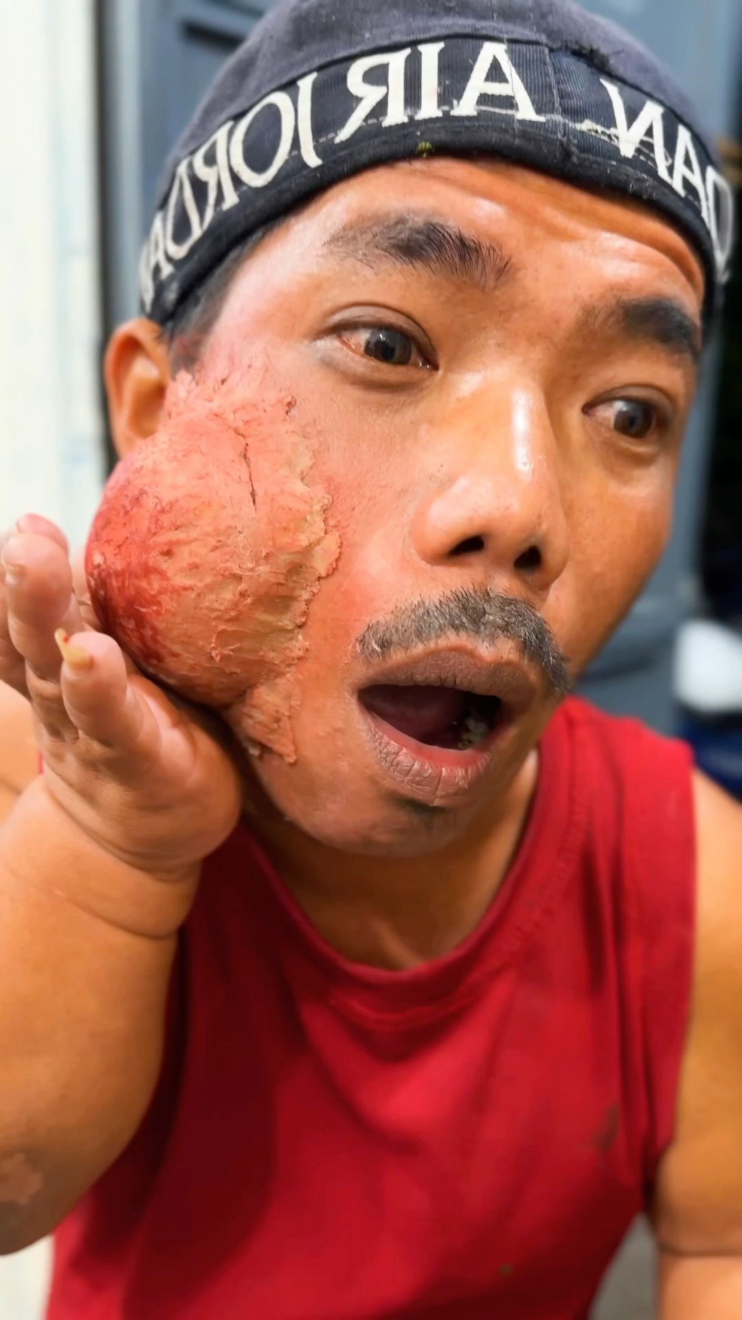 ToRung comedy: my teeth hurt so much ?