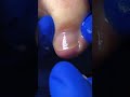 Satisfying Toenail Grooming | Gentle Foot Care Routine #fypシ #cleannails #RelaxingCare #fypシ