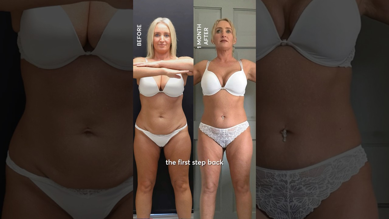 Мама семерых детей попробовала CoolSculpting! Цель по фигуре на 2026 год 🔥