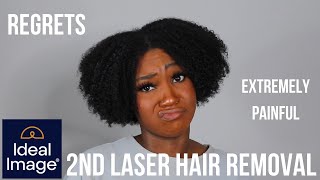 2nd Laser Hair Removal Treatment | Brazilian & Underarms Regrets| Ideal Image