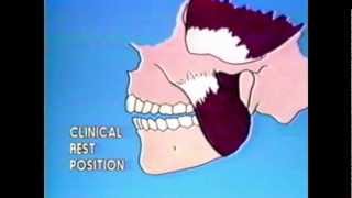 Mandibular Rest Position