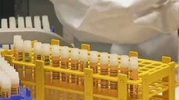러시아, 에볼라 백신 2종 개발…"초기 실험서 효과 확인"
