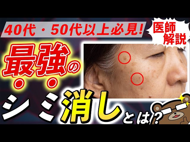 シミの治療 このシミをどう治す? Amazon.co.jp: シミの治療: このシミをどう治す? : 葛西健一郎: 本