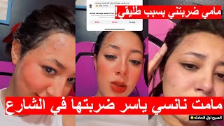 مامت نانسي ياسر ضربتها في الشارع بسبب يوسف طلقها 😱💔