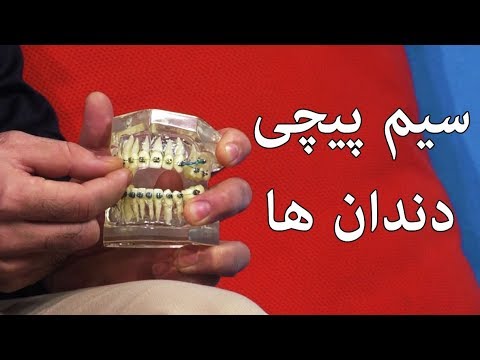 تصویری: پاندا چند دندان دارد