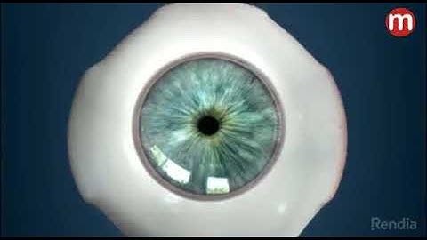 iStent Inject - Trabecular Micro-Bypass System at Medpick