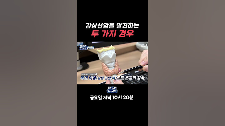 갑상선암은 보통 이러다가 발견됩니다!