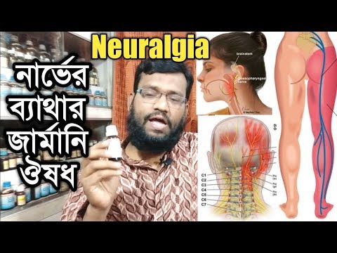 যেকোন নার্ভের ব্যাথার জার্মানি হোমিওপ্যাথি ঔষধ | Neuralgia Pain Homeopathy treatment in Bangla