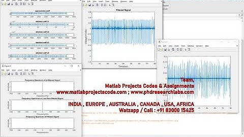 ECG SIGNAL PROCESSING | MATLAB PROJECTS | WWW.MATLABPROJECTSCODE.COM | WWW.PHDRESEARCHLABS.COM