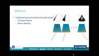 Enhancement Of Specular Refletinos Using Modfied Radon Transform On A 2D Phased Array