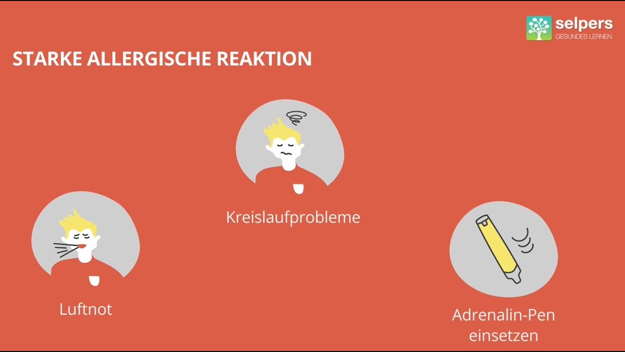Wie Lange Dauert Es Bis Zum Allergischen Schock Anaphylaktischer Schock - Erste Schritte im Notfall! (Ärztin erklärt