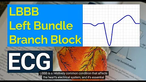 Understanding Left Bundle Branch Block (LBBB) on ECG:  Causes, Symptoms, and Treatment.