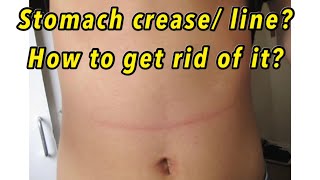 Stomach crease? How to get rid of it?