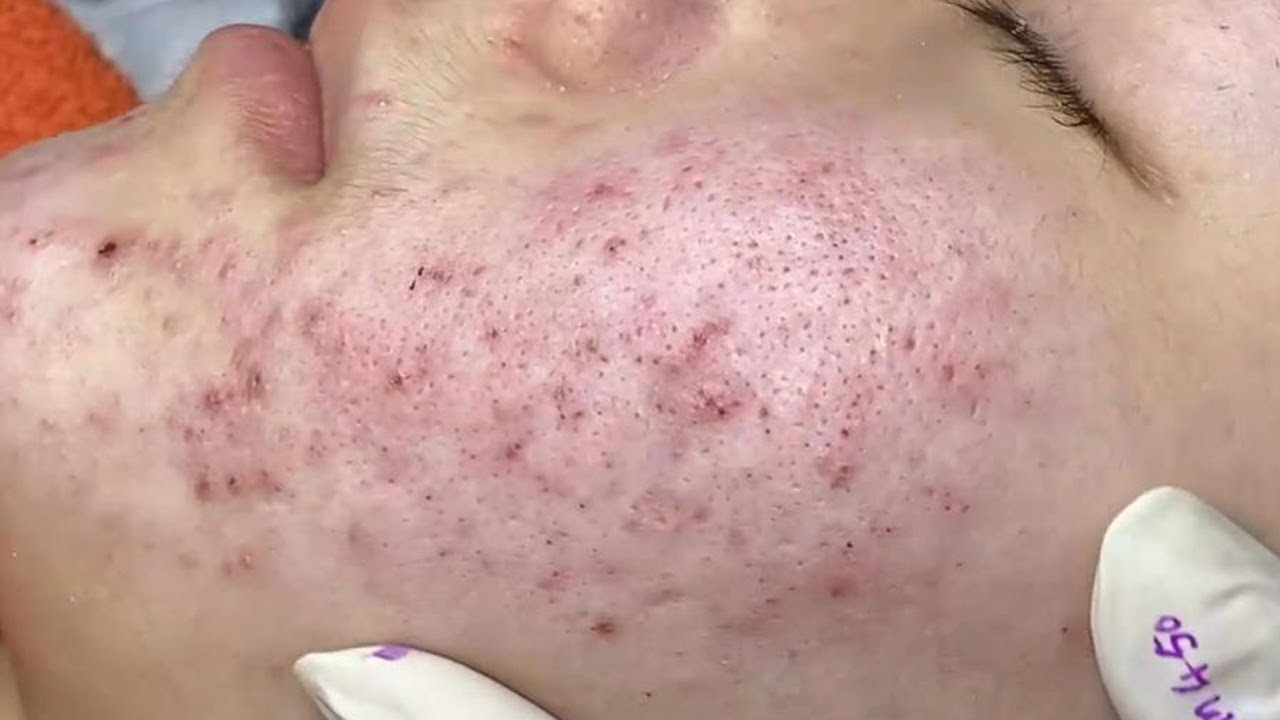 Satisfying With Loan Nguyen Spa Video #040