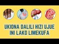 Ukiziona Hizi Dalili 12 Ujue Ini Lako Tayari Limeshaharibika Linahitaji Msaada Ukiziona Hizi Dalili 12 Ujue Ini Lako Tayari Limeshaharibika Linahitaji Msaada