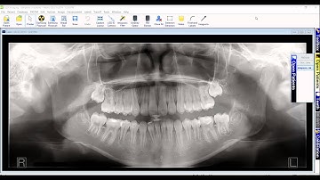How to move an image to the correct patient chart
