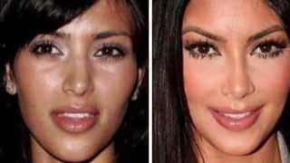 Kim Kardashian antes e depois rosto / face before and after / cara antes y despues